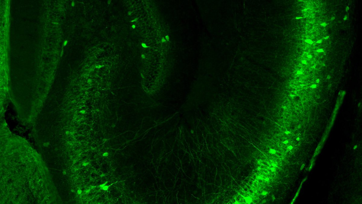 Fluorescently labelled neurons of the wakefulness circuit targeted by orexin receptor agonists — a Panacea Bio Chem pharmacology record by Bogdan Dicoias